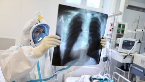 На Кировоградщине в тяжелом состоянии 40 человек с коронавирусом