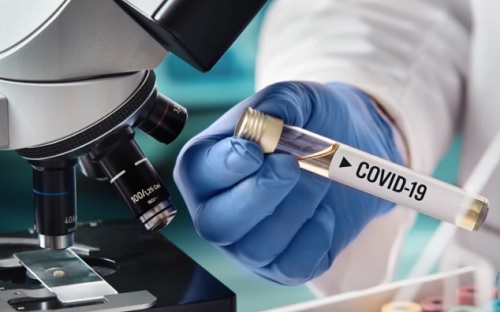 На COVID-19 заболел житель Кировоградщины
