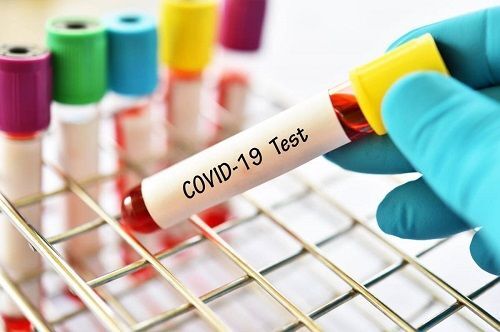 Ситуація з COVID-19 на Кіровоградщині: лікарі виявили нові випадки