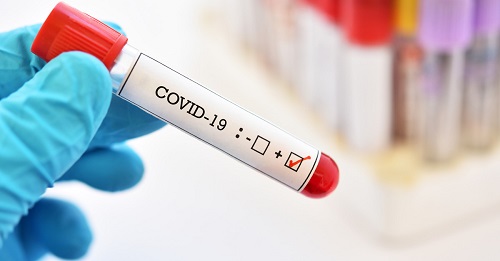 COVID-19 продовжує крокувати Кіровоградщиною: нова статистика