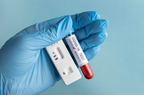 На Кіровоградщині зростає кількість хворих на COVID-19. Що з вакцинацією?
